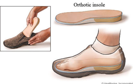 Orthotics/insoles